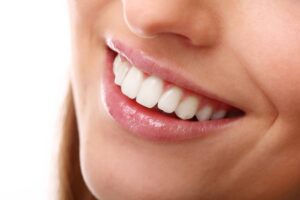 sonrisa ortodoncia invisible