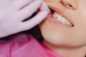 Ortodoncia invisible y la enfermedad periodontal