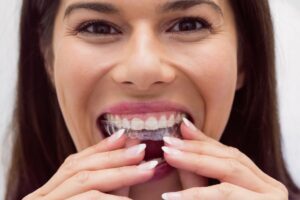 gomas en Invisalign