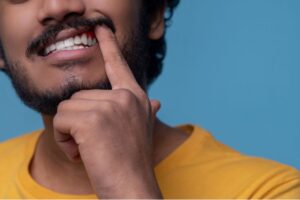 Es normal sangrar con el Invisalign