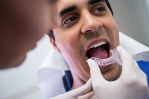 ¿Qué es el refinamiento Invisalign?